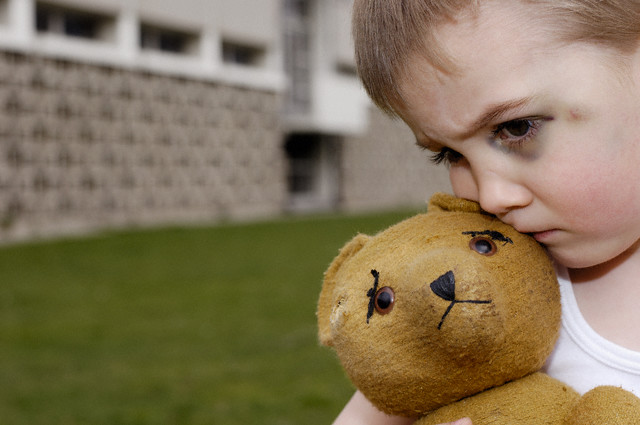 Boy with Black Eye Hugging Teddy Bear --- Image by © Guntmar Fritz/zefa/Corbis